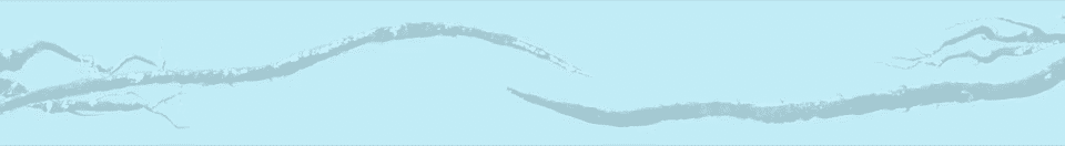desmoid tumor tendril